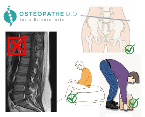 Votre ostéo à Nice vous aide à comprendre le mal de dos